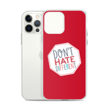 Don't Hate Different (iPhone Case)